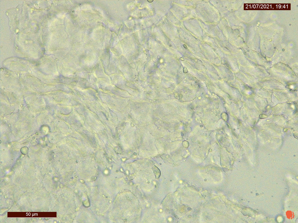 Corneocite. Hife. Microscop